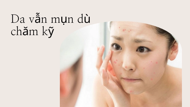 Tại sao da bị mụn dù chăm sóc kỹ?