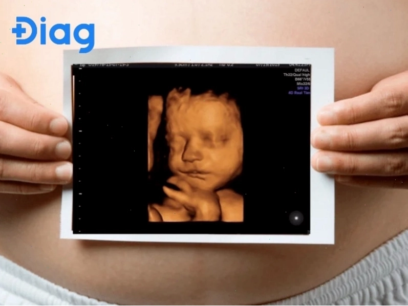 So sánh hình ảnh siêu âm 6D với các công nghệ cũ